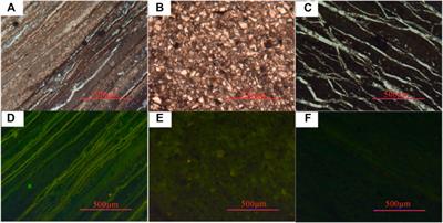 Study on gas accumulation conditions of continental shale in Es3 member in the northern dongpu depression, eastern China